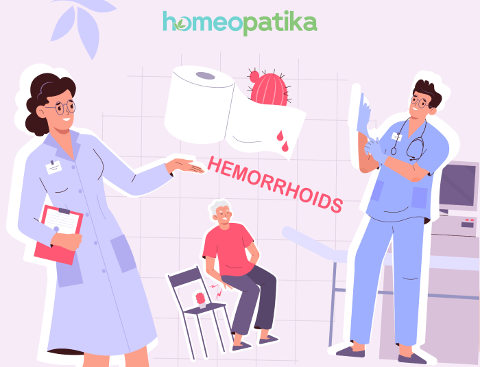  vyšetření hemoroidů